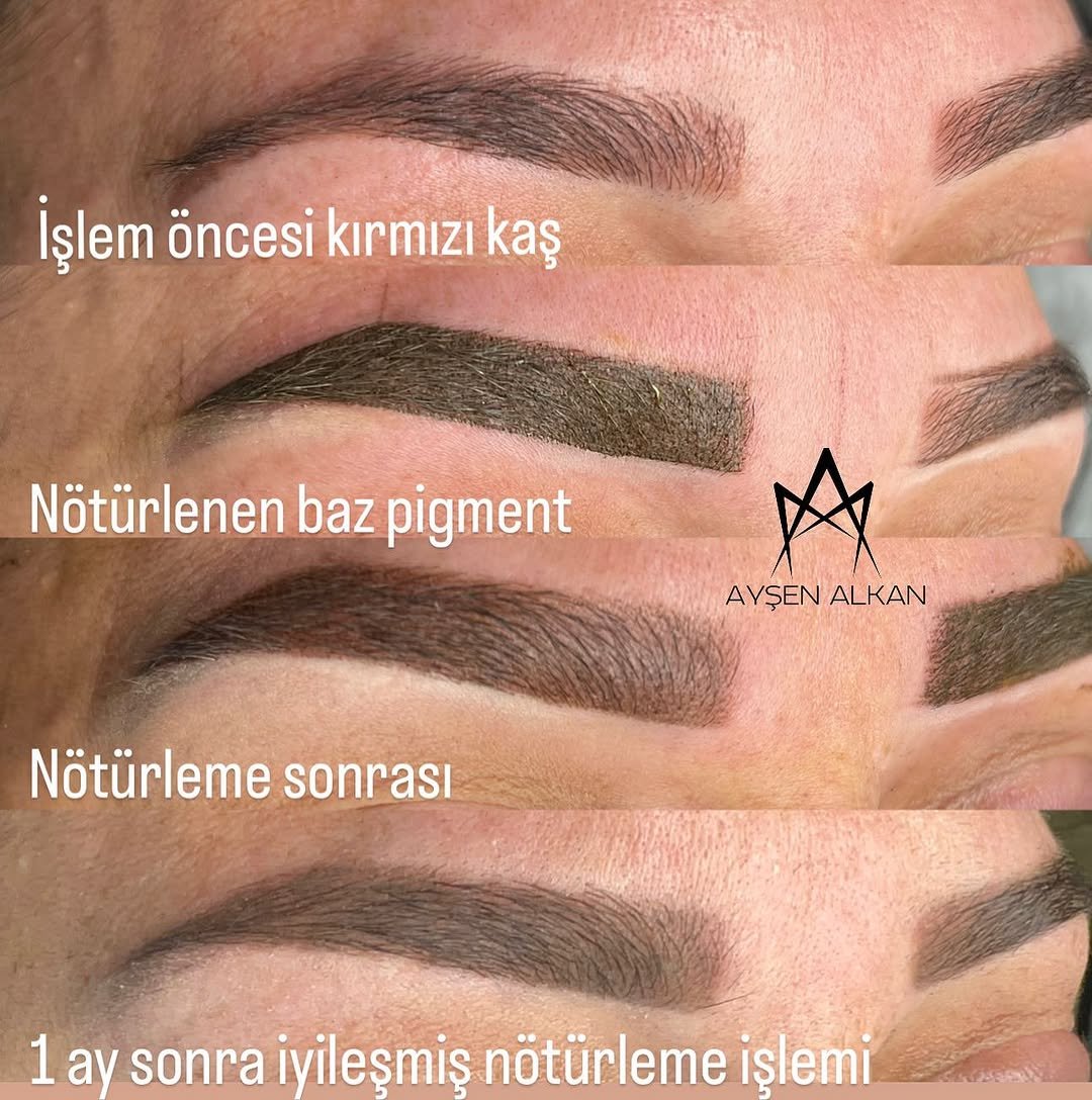 Ayşen Alkan